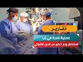 عملية نادرة في إب.. استئصال ورم خطير من الحبل الشوكي!