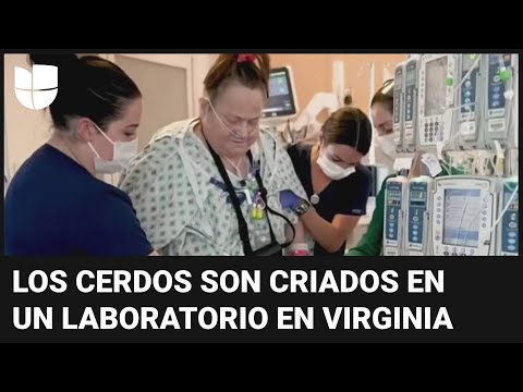 Mujer de EEUU, la segunda paciente que recibe trasplante de riñón de cerdo genéticamente modificado