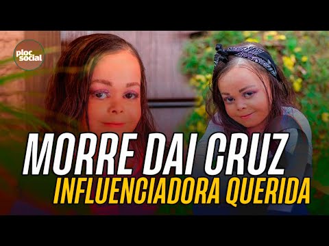 Morre influenciadora Dai Cruz com mais 2,5 milhoões de seguidores e sofria de Epidermólise Bolhosa