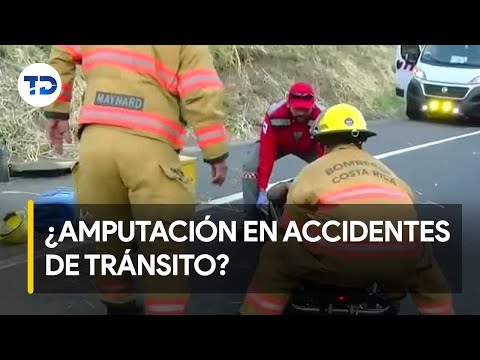Víctimas de amputación por accidentes de tránsito en su mayoría son hombres