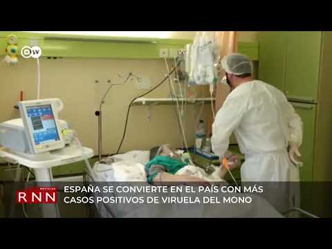 España es el país con más casos de viruela del mono