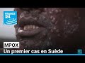 Mpox  un premier signalement en Su?de, l'OMS alerte sur le risque d'autres cas import?s en Europe