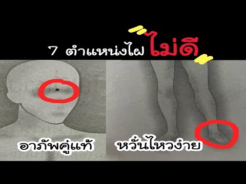 7ตำแห่งไฝไม่ดี