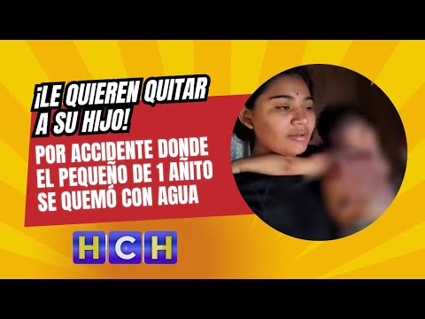 ¡Le quieren quitar a su hijo! por accidente donde el pequeño de 1 añito se quemó con agua hirviendo