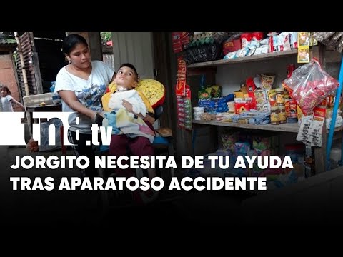 Jorgito, niño que sufrió accidente, necesita de ayuda urgente - Nicaragua