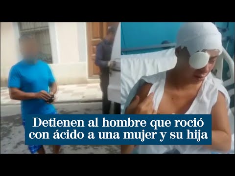 Detienen al hombre que roció con sosa cáustica a una mujer y su hija en Girona
