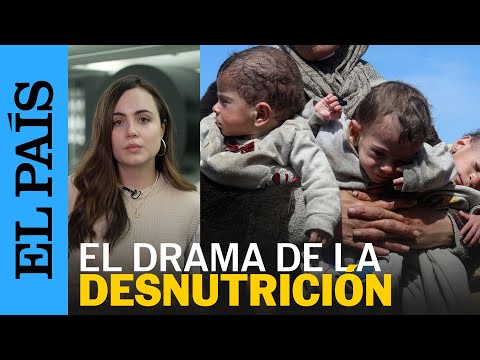 Desnutrición en Gaza: las secuelas irreversibles que puede dejar el hambre en los niños | EL PAÍS