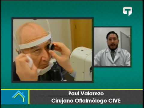 Día mundial del Glaucoma: Existen señales tempranas de alerta