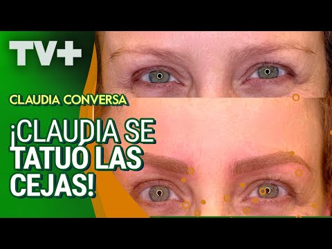 La intervención estética de Claudia Conserva