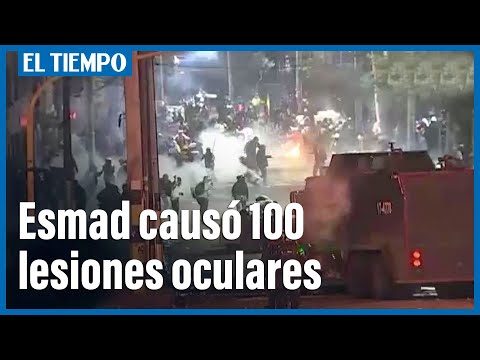 Actuar desmedido del Esmad, causó 100 lesiones oculares a manifestantes