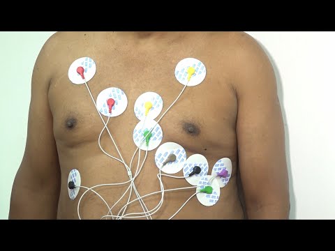 Inicia distribución de equipos de monitorización electrocardiográfica en hospitales de Nicaragua