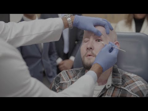 Primicia médica: hombre recibe con éxito el primer trasplante de ojo completo del mundo