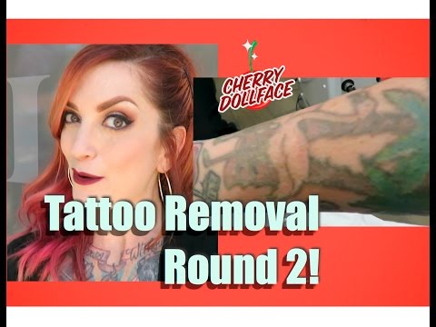 download youtube mp3 first laser tattoo removal session by download youtube mp3 first laser tattoo removal session by