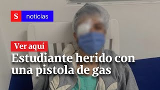 Estudiante casi pierde un ojo tras recibir un disparo con una pistola de gas de la policía en Pasto