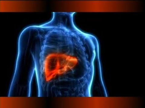 La cirrosis hepática y el cáncer en el hígado