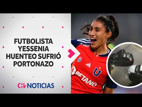 Futbolista de Universidad de Chile, Yessenia Huenteo, sufrió violento portonazo