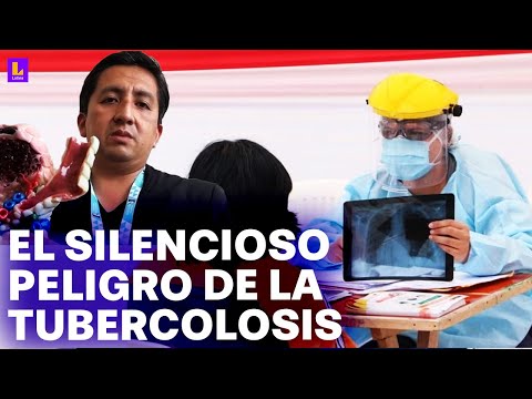 ¿Cómo detectar a tiempo y protegernos de la tuberculosis?