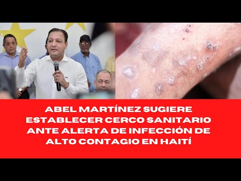 ABEL MARTÍNEZ SUGIERE ESTABLECER CERCO SANITARIO ANTE ALERTA DE INFECCIÓN DE ALTO CONTAGIO EN HAITÍ