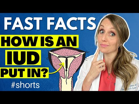 How is IUD put in the uterus? #shorts
