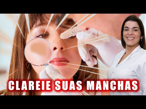 Thumbnail Video Youtube