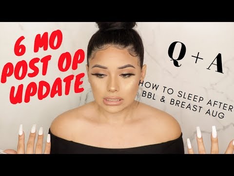 How To Sleep After BBL & Breast Aug + 6 Month Post Op Update ++ Q&A
