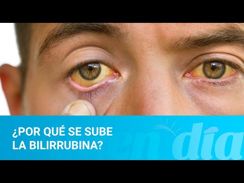 ¿Por qué se sube la bilirrubina?