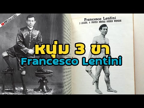 ชายผู้มี3ขาFrancescoFrank