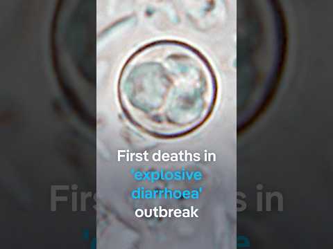 US reports first deaths from parasite that causes explosive diarrhea | DW News
