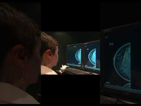 Lesser-Known Breast Cancer Surging in US, Report Warns