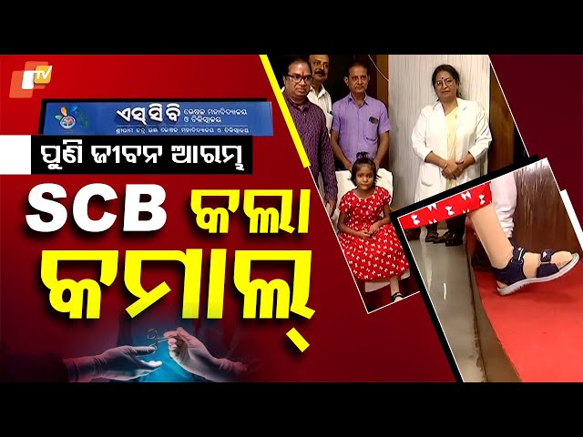 Special Story: "From Tragedy to Triumph: Odisha Girl's Journey to Recovery with Prosthetic Limb"
