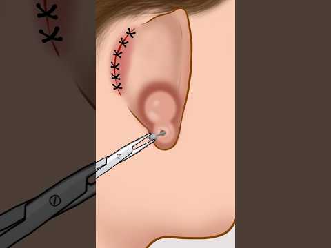 This is why you need to care about your piercings #asmr #animation #satisfying #shorts