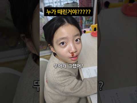 누가 때린거야??? 어!?!