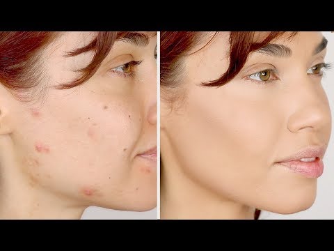 HOW TO COVER ACNE | Flawless Foundation Routine for Acne | Eman