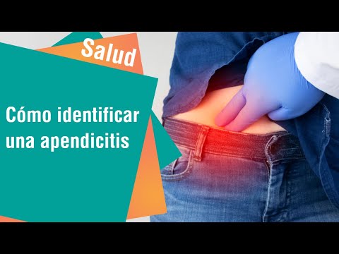 Aprenda a diferenciar la apendicitis de otros padecimientos | Salud