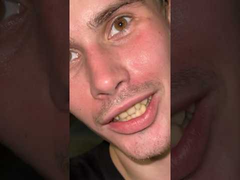 Зачем он в кадр залез?🫠 #skate #skateboarding #rollerskating