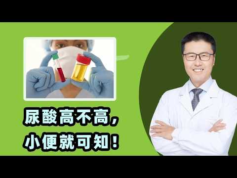 尿酸高不高，小便就可知｜这3个异常，可能尿酸高。排尿不通畅、排尿次数异常、尿液颜色异常｜预防高尿酸：少吃高嘌呤、控制体重！果糖食品特别关注！甜饮料、蜂蜜、糖浆、烘焙糕点、水果（中医养生）【老安谈健康】
