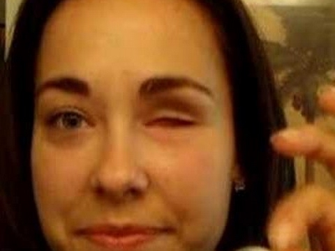 -_-  i'm using a bionic eye