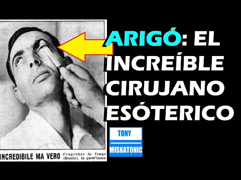 ZÉ ARIGÓ: EL INCREÍBLE CIRUJANO ESÓTERICO. EL CIRUJANO MEDIUM DE LA NAVAJA OXIDADA. DR. FRITZ