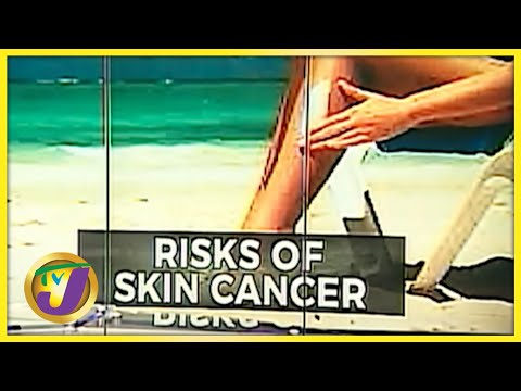 Over Expose to the Sun | Risk of Skin Cancer | TVJ News - July 28 2021