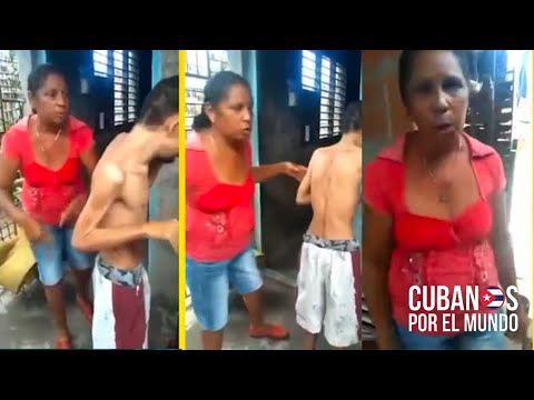 “Si hay revolución quiero verla”, dice una madre cubana que muestra a su hijo desnutrido y enfermo.