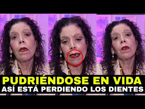 Rosario Murillo se está PUDRIENDO EN VIDA: Así está perdiendo la dentadura