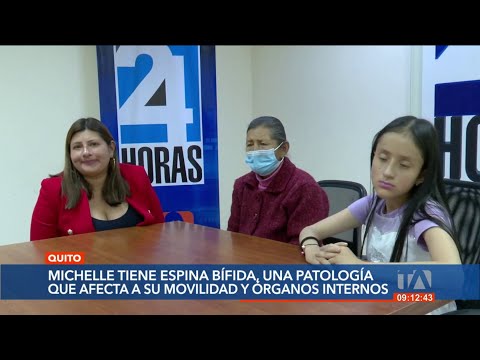 #Manos Solidarias: Michelle nació con espina bífida y pide su ayuda