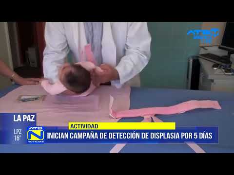 Ministerio de Salud lanza campaña de detección de displasia de cadera para menores de un año