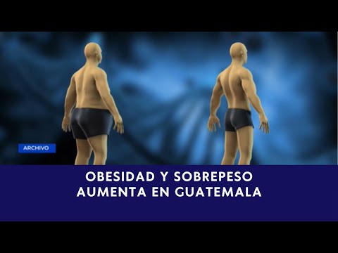 Expertos alertan sobre el creciente problema de obesidad en Guatemala