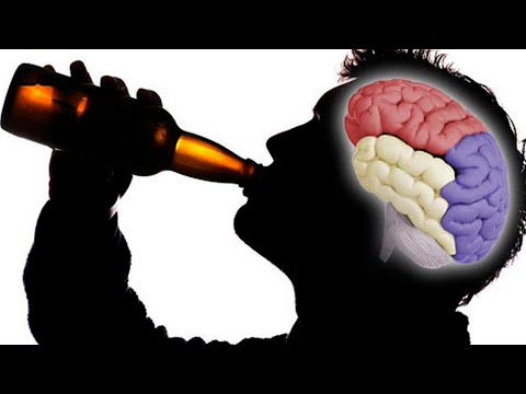 Efectos del alcohol en el cerebro del ser humano