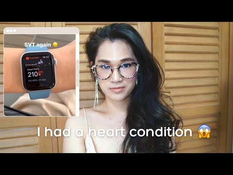 My-SVT-Heart-ablation-story-(S My-SVT-Heart-ablation-story-(S