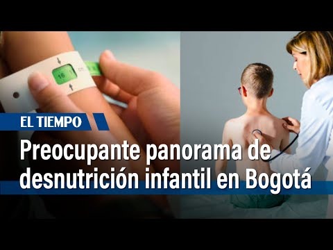Preocupante panorama de desnutrición infantil en Bogotá, Alcaldía toma medidas | El Tiempo