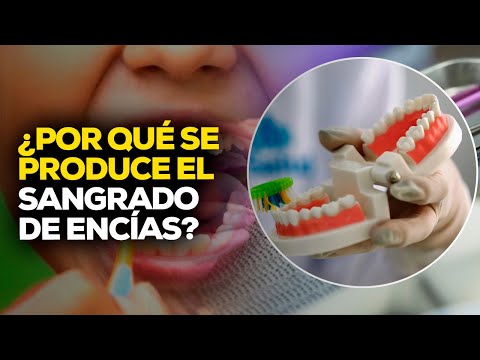 ¿Cómo cuidar la salud bucodental para tener una sonrisa sana? #ROTATIVARPP | SEGMENTO