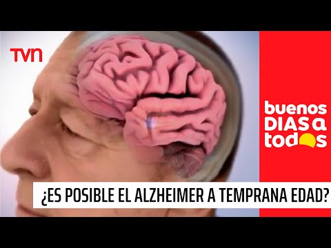Alzheimer: ¿Puede desarrollarse a temprana edad? | Buenos días a todos