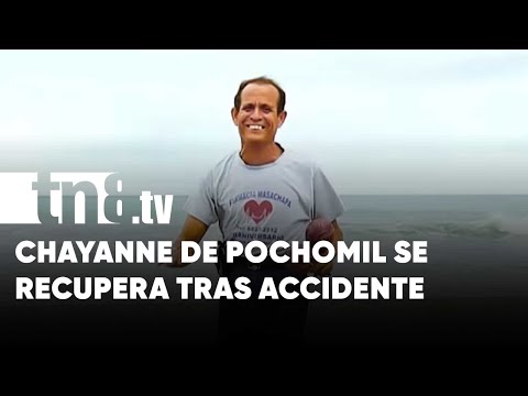 El «Chayanne de Pochomil» sigue enérgico y recuperándose de accidente - Nicaragua